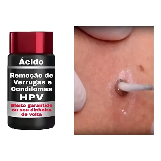 Ata Tca Composição 100% 2,5ml.