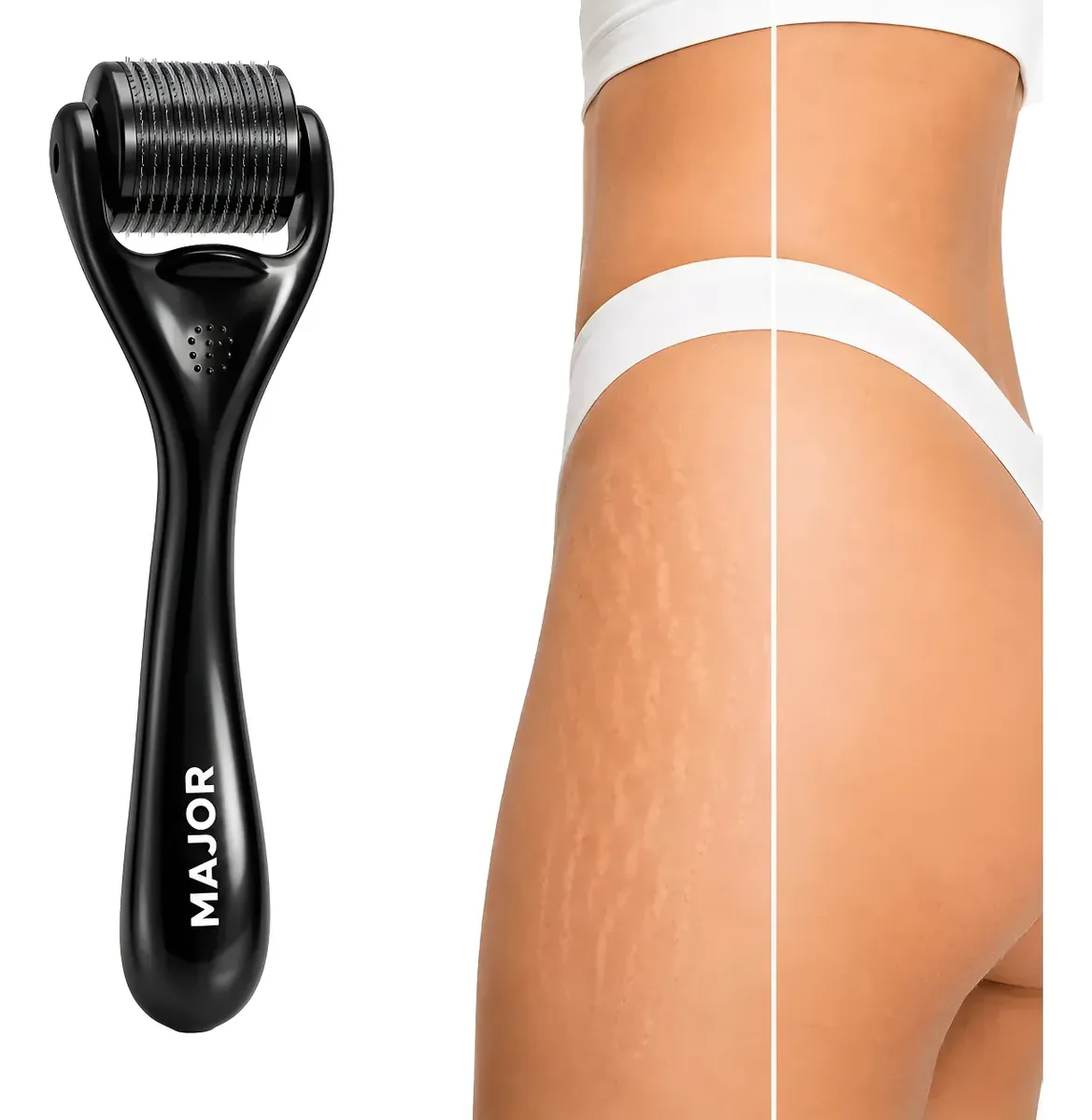 Derma Roller System Microagulhamento 1mm 1 Rolo Titânio 0.5mm